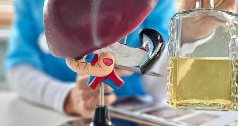 Alcoholic Liver Disease