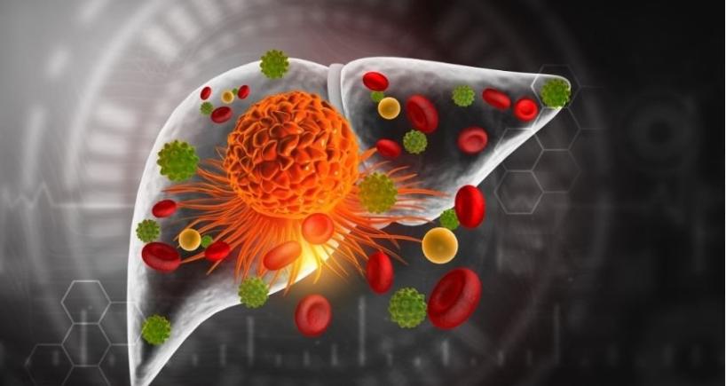 Can Advanced Liver Cancer Become Operable
