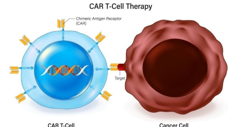 Cost Access and Where to Get CAR-T Therapy