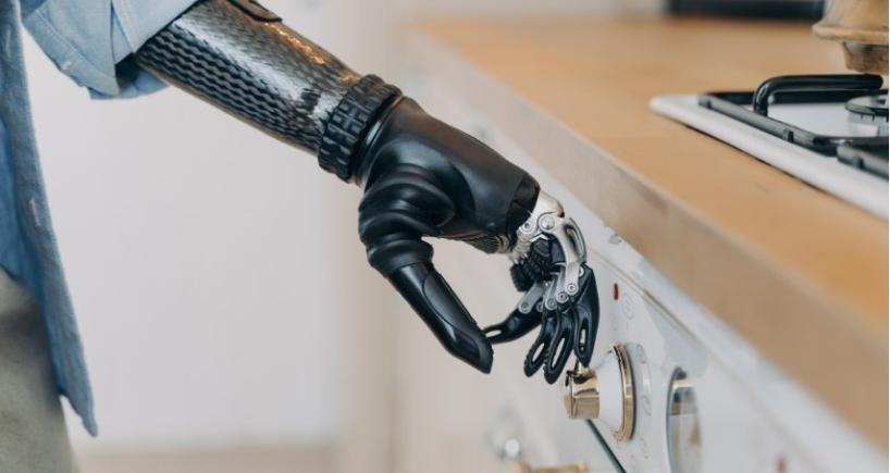 Hand Transplant vs Prosthetic Hand-Which Option Changes Life More
