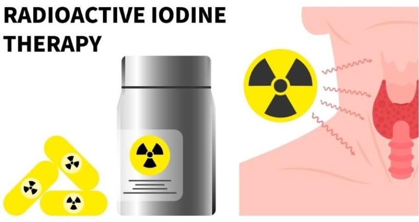 Why Dose Matters in I-131 Therapy
