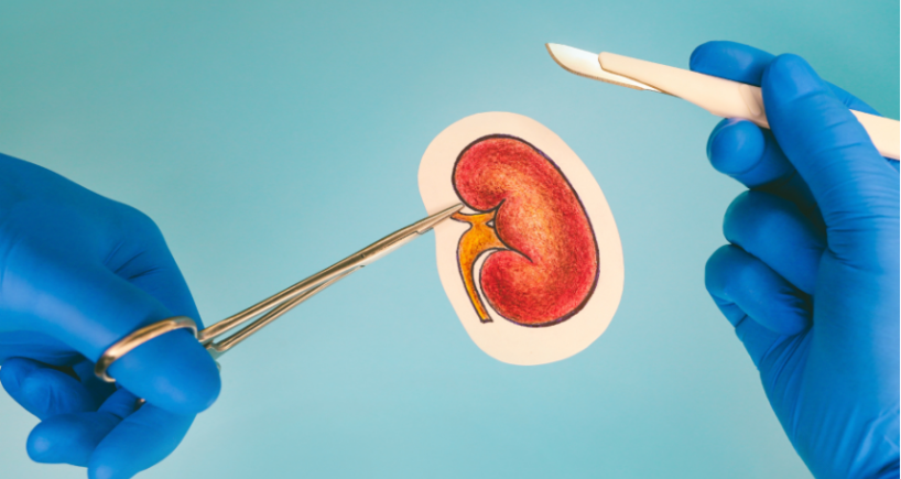 Managing Immunosuppressant Side Effects in Kidney Transplant