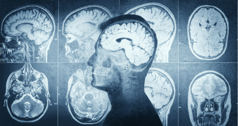 Post-Op Protocols That Drive Better Outcomes After Endoscopic Brain Surgery