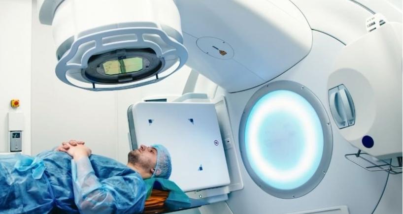 SBRT vs Traditional Radiation