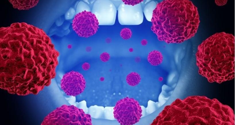 Seven Sites of Mouth Cancer Explained Simply