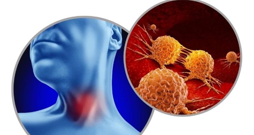Treatment Options for HPV-Related Head and Neck Cancer