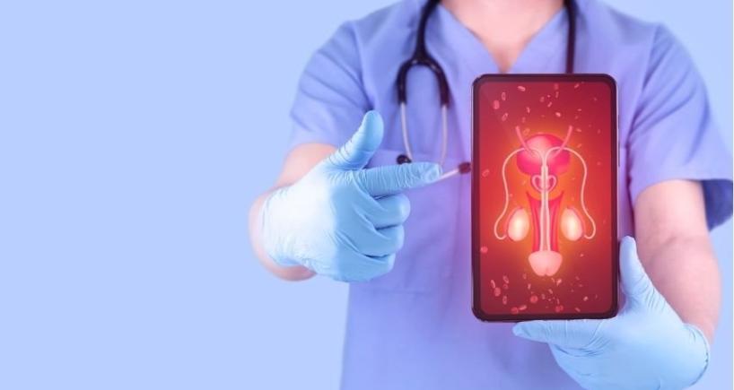 Varicocele Embolization vs Surgery
