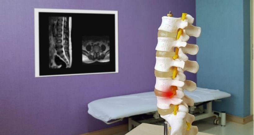 What Spine Problems Can Endoscopic Surgery Actually Fix