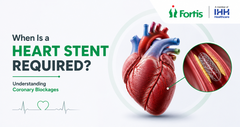 When Is a Heart Stent Required and Understanding Coronary Blockages