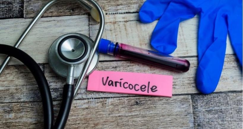 Why Does Testicular Pain Come and Go