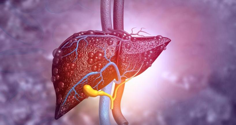 Difference between liver cancer and liver cirrhosis