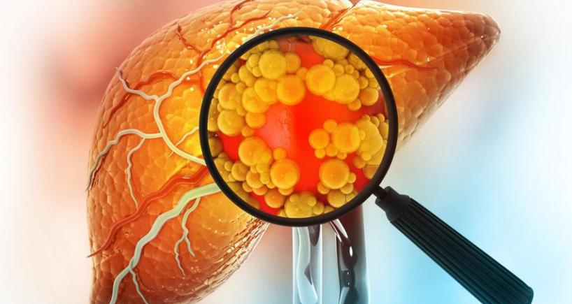 Liver Functions and Disease - What You Need to Know