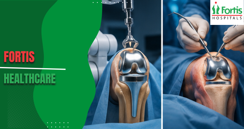 Robotic vs Non-Robotic Knee Replacement