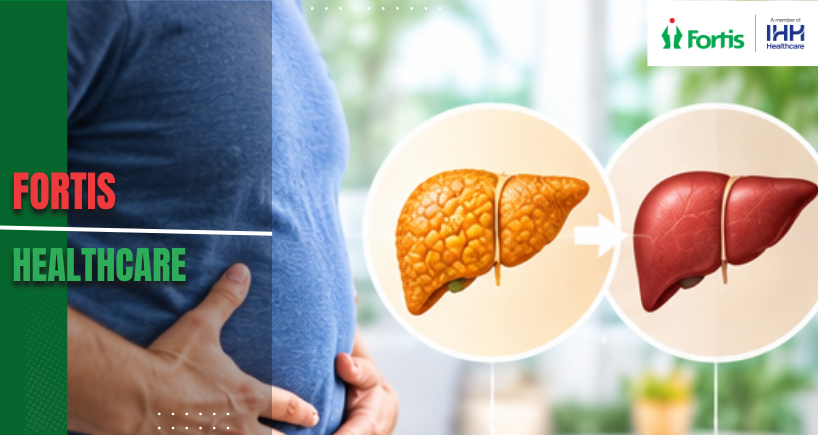 Fatty Liver and Diabetes