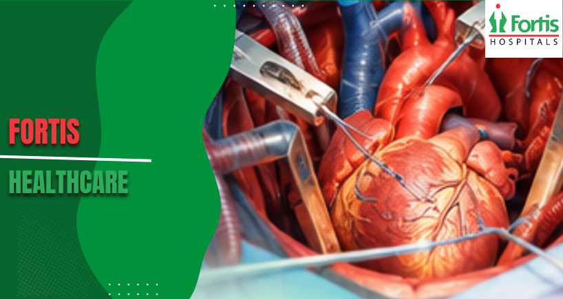 Open Heart Surgery