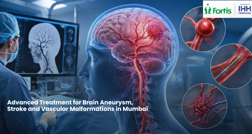 Advanced Neurovascular Treatments in Mumbai