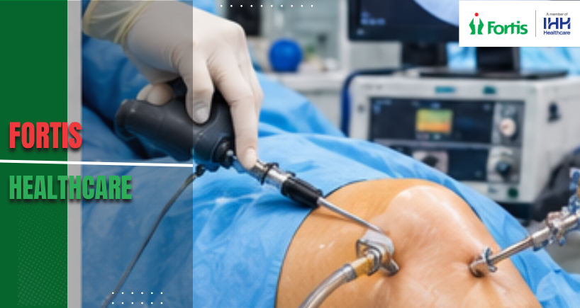 Arthroscopic Surgeon in India