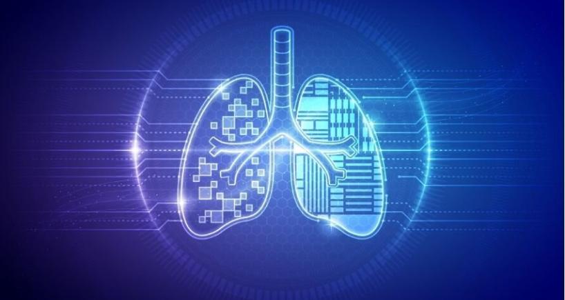 What Happens During a Navigation Bronchoscopy