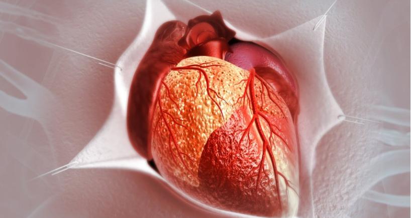 What It Is and Why More Heart Patients Are Choosing