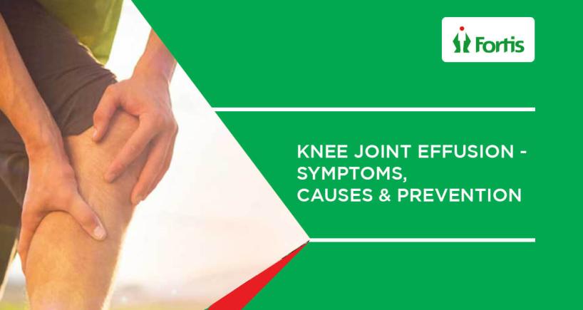 Knee Joint Effusion - Symptoms, Causes & Prevention