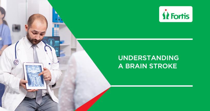 Understanding Brain Stroke | Risk, Causes & Prevention - Fortis Kalyan