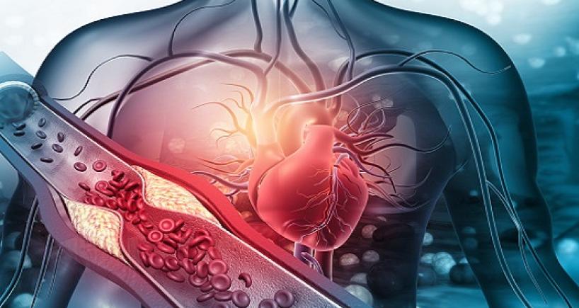 Understanding The Signs of Heart Attack