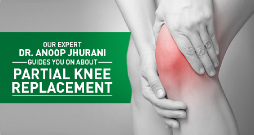 Partial Knee Replacement: A Boon For Early Arthritis
