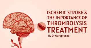 Ischemic stroke