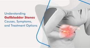 Gallbladder Stones: Causes, Symptoms, and Treatment Options