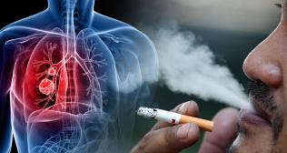 Passive Smokers and Lung cancer