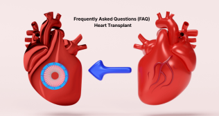 Heart Transplant 