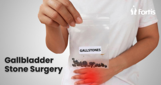 Best Gallbladder Stone Surgery in Navi Mumbai