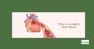 Complete Heart Block क्या है