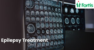 Best Epilepsy Treatment in Mumbai