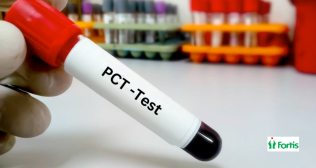 पीसीटी रक्त परीक्षण (PCT Test)
