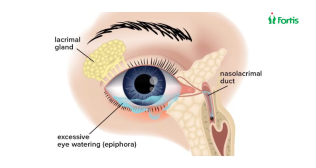 गीली आँखें (Watery Eyes)