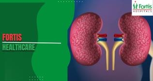 Kidney Transplants