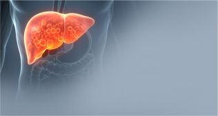 Fatty Liver Disease