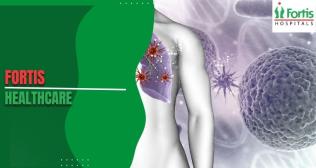 Choriocarcinoma Explained