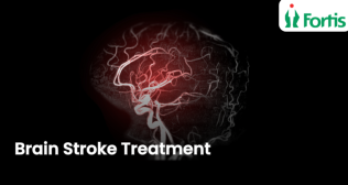 Best Brain Stroke Treatment in Navi Mumbai