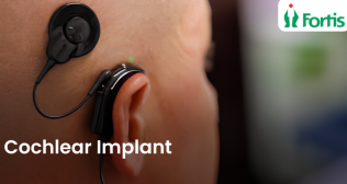 Best Cochlear Implant Surgery in Mumbai