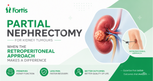 Partial Nephrectomy for Kidney Tumours