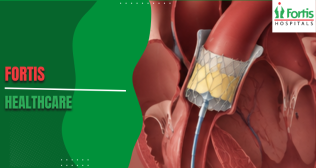 Recovery Timeline After TAVR Surgery