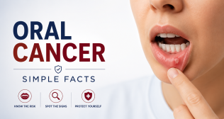 Oral Cancer : Simple Facts