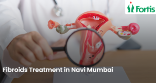 Best Fibroids Treatment in Navi Mumbai