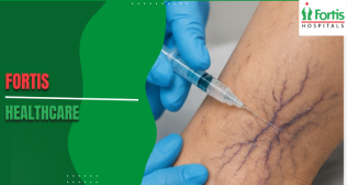 Treating Venous Malformations in Children