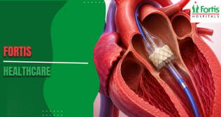TAVR Surgery