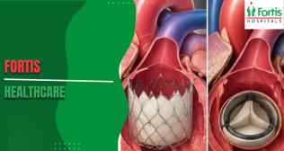 TAVR vs SAVR 
