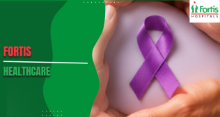 Stages of Wilms Tumor