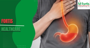 Esophageal Motility Disorders
